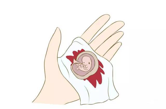 【世界避孕日资料】人工流产有风险